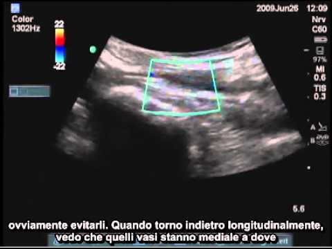 Trattamento dei muscoli della schiena miosite recensioni Trattamento nard dei giunti