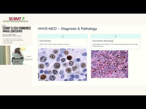 Lymphoma mimickers & Diagnostic Traps | Alfadel Alshaibani | 31 JAN 2026