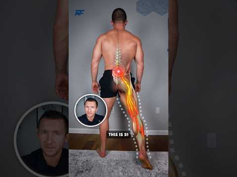 L4, L5, S1 Nerve Pain — 3 Exercises to Relieve It