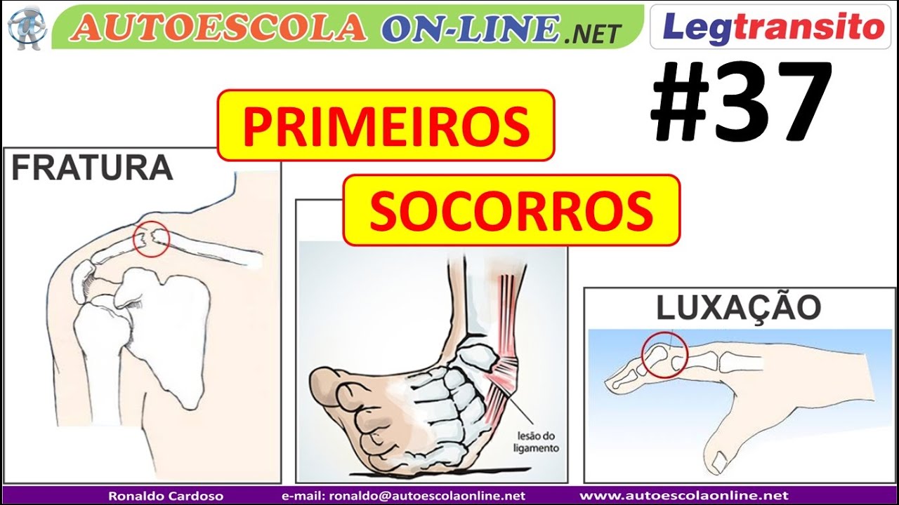 Fratura; Amputação; Queimadura - PRIMEIROS SOCORROS