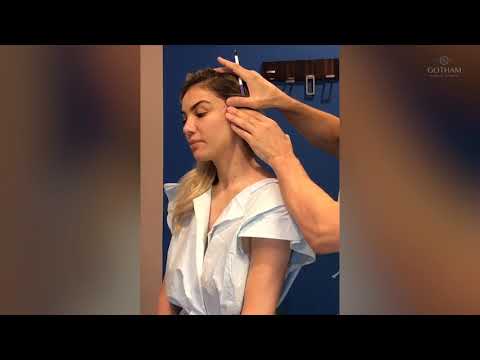 Ponytail Micro Lift Procedure by Dr. Miller
