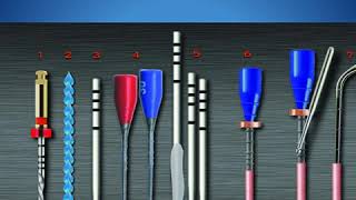 Overfilling in Endodontics Part II