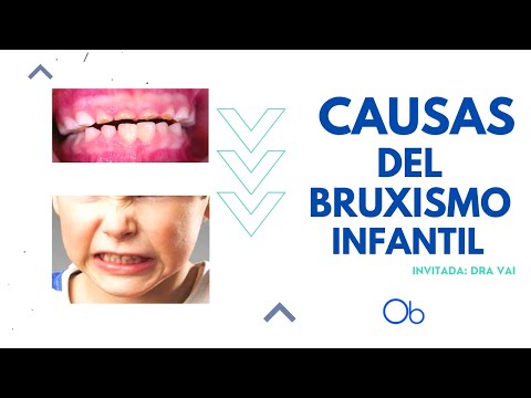 Causas del Bruxismo dental infantil