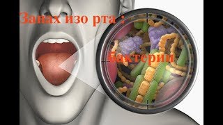 ЛЕЧЕНИЕ НЕПРИЯТНОГО ЗАПАХА ИЗО РТА . #ГАЛИТОЗ #запах_изо_рта #helicobacter_pylori #oldenburgru#110