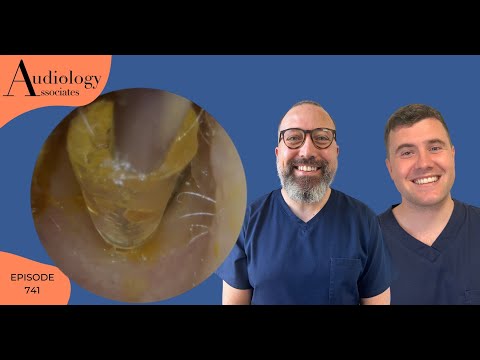 MYSTERY OBJECT REMOVAL FROM A PATIENTS EAR - EP741