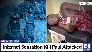 Internet Sensation Kili Paul Attacked