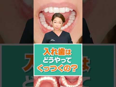総入れ歯はどうやってくっつくの？