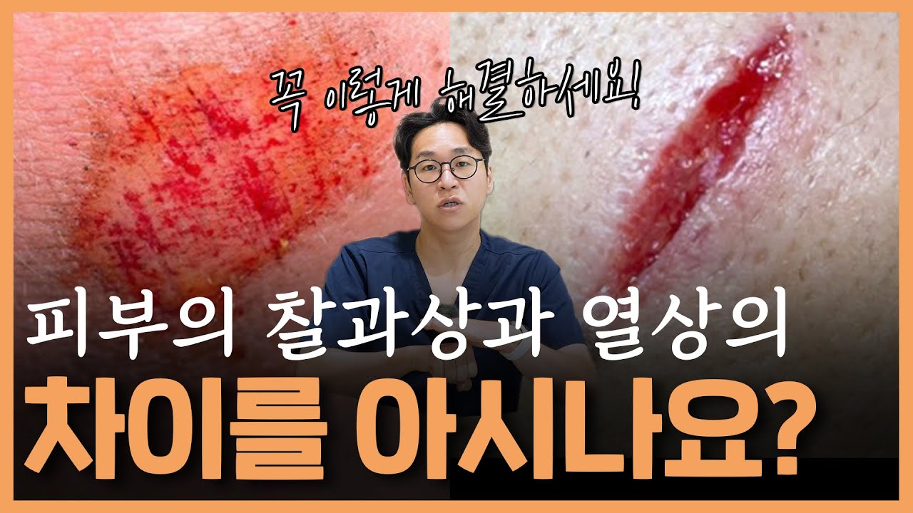 피부 상처와 흉터 관리