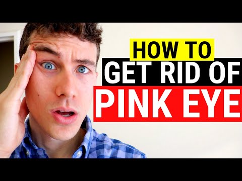 🔴 How to Get Rid of Pink Eye | 3 Must Know Facts About Pink Eye and Conjunctivitis