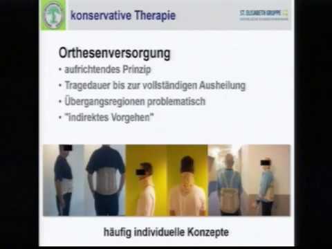 Behandlung von Gelenken Hormone Operation an der Schulter Endoprothetik auf Bewertungen