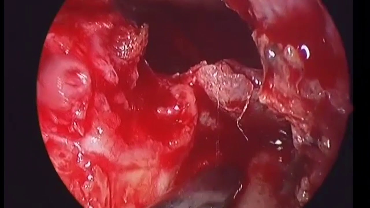 Nelson Almeida D'avila Melo-16