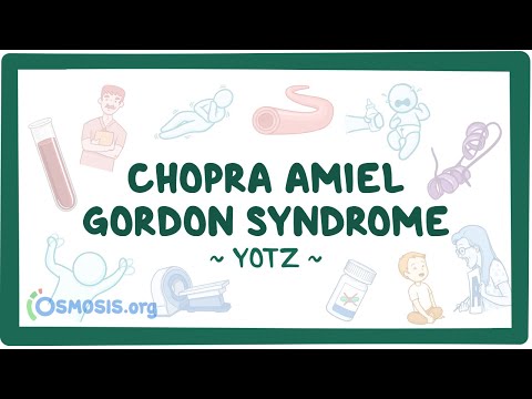 Achalasia Year of the Zebra