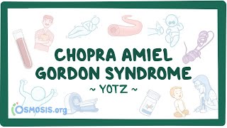 Chopra-Amiel-Gordon syndrome (Year of the Zebra 2024)