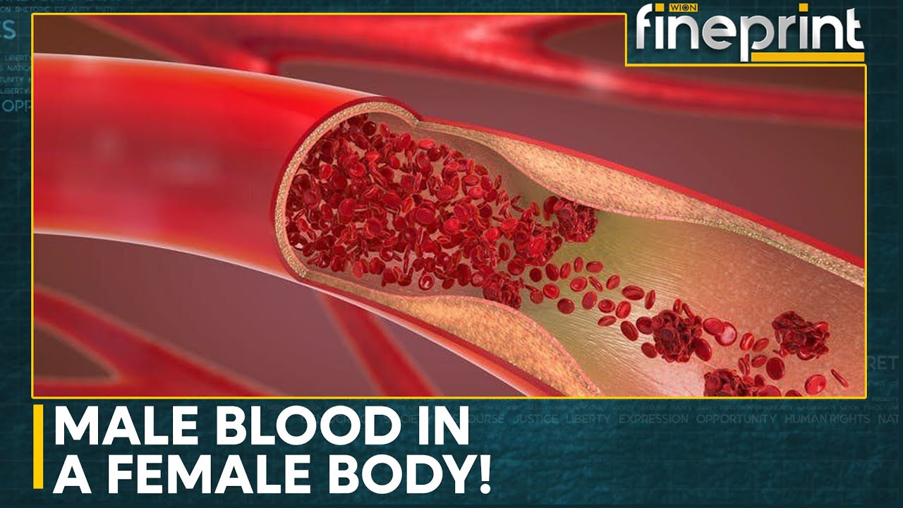The Impossible Discovery: Scientists Baffled by Woman's Male Blood Discovery | WION Fineprint