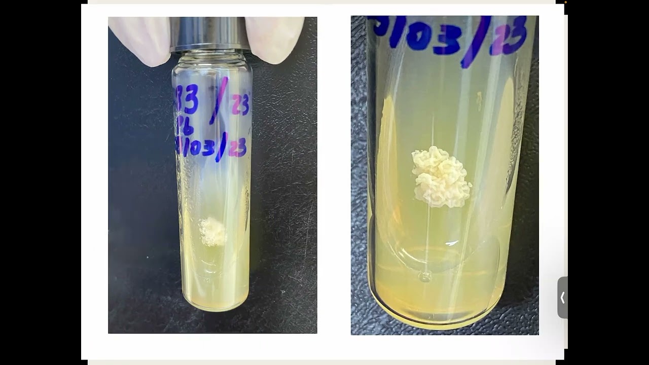 03/2023 - Caso: Lesão de pele nódulo-ulcerativa em PVHIV