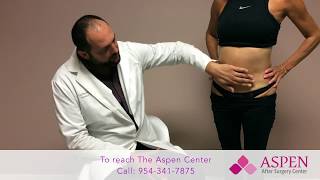 Liposuction Contour Irregularity / Stubborn Lipo Lumps and Bumps