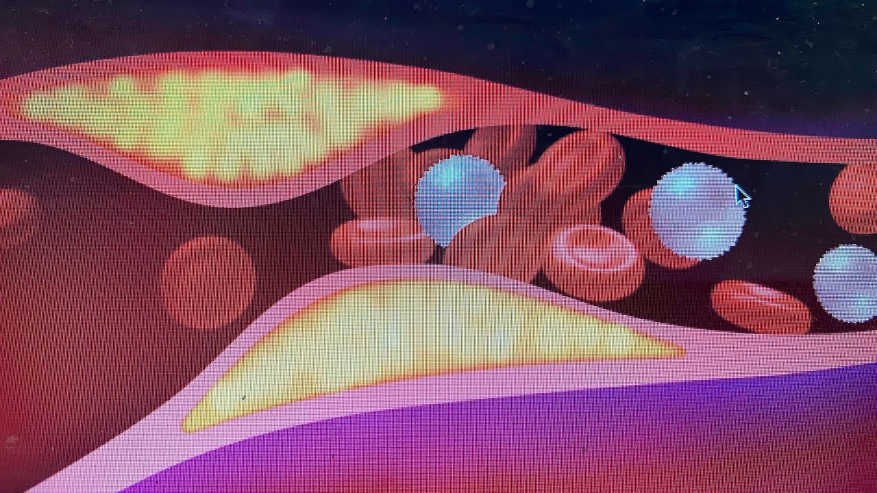 Como limpar a gordura das artérias em casa? | Dr. Dayan Siebra