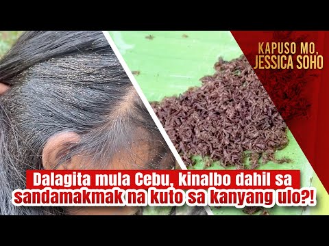 Dalagita mula Cebu, kinalbo dahil sa sandamakmak na kuto sa kanyang ulo?! | Kapuso Mo, Jessica Soho