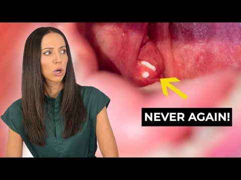 can you catch herpes from sharing a cigarette Herpes isn't just an STD ❌ Learn all the ways it can spread — knowledge is  your best protection. #HealthAwareness #HerpesEducation #PreventionMatters  #HealthFacts #BreakTheStigma WellnessTips HealthEducation