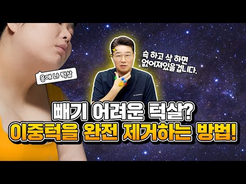 [얼지흡의 정석] 닥터정이 말하는 이중턱지방흡입
