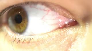 Eye Rotation Of The Eyeball, Close-up of human eye that blink, crazy looks around