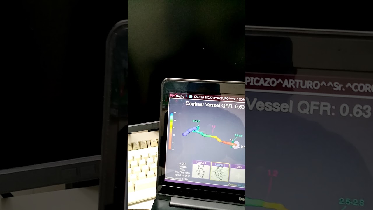 Héctor Hugo Escutia Cuevas-17