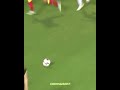 Eden Hazard broken leg