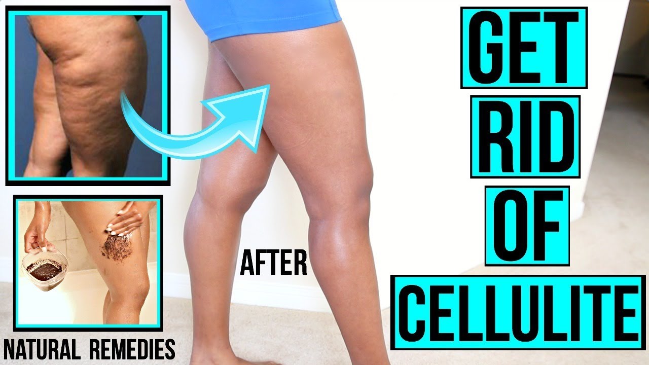 HOW TO GET RID OF CELLULITE FAST & NATURALLY + DIY AT HOME SCRUBS & MIXES