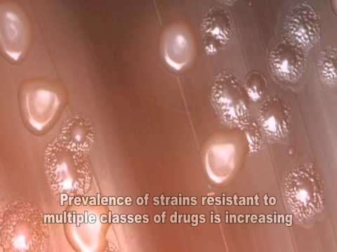 Streptococcus pneumoniae