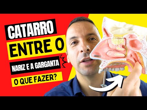 COMO ELIMINAR O CATARRO QUE FICA ENTRE O NARIZ E A GARGANTA