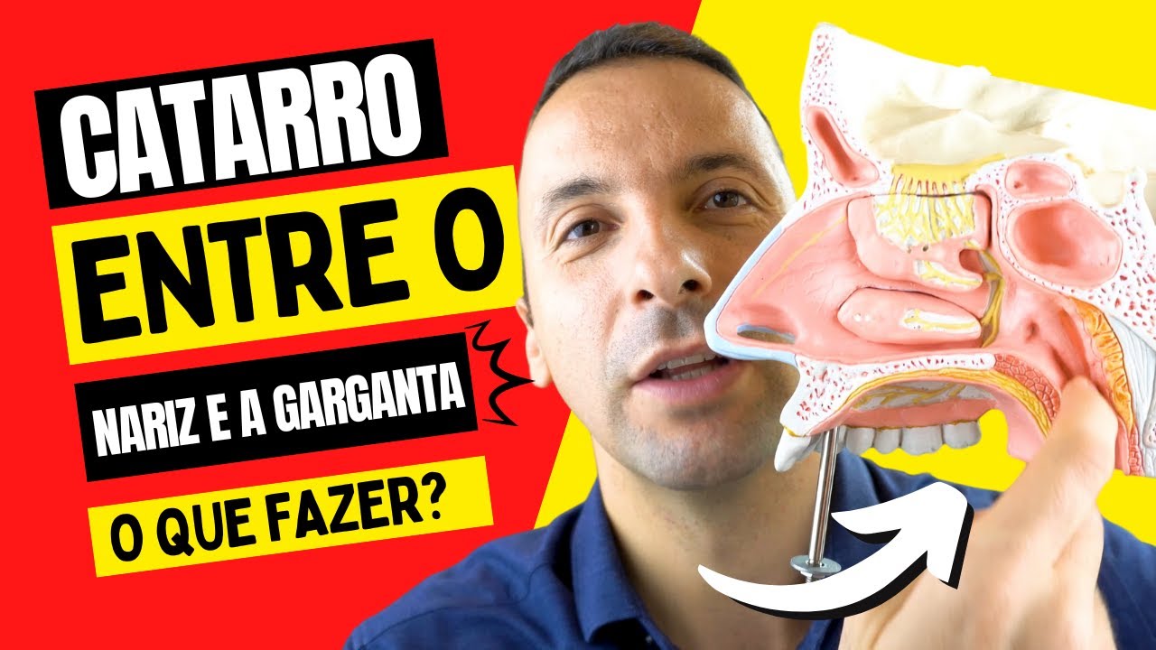 COMO ELIMINAR O CATARRO QUE FICA ENTRE O NARIZ E A GARGANTA