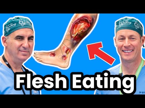 Flesh Eating Disease - Necrotizing Fasciitis- Infectious Disease Doctor Explains