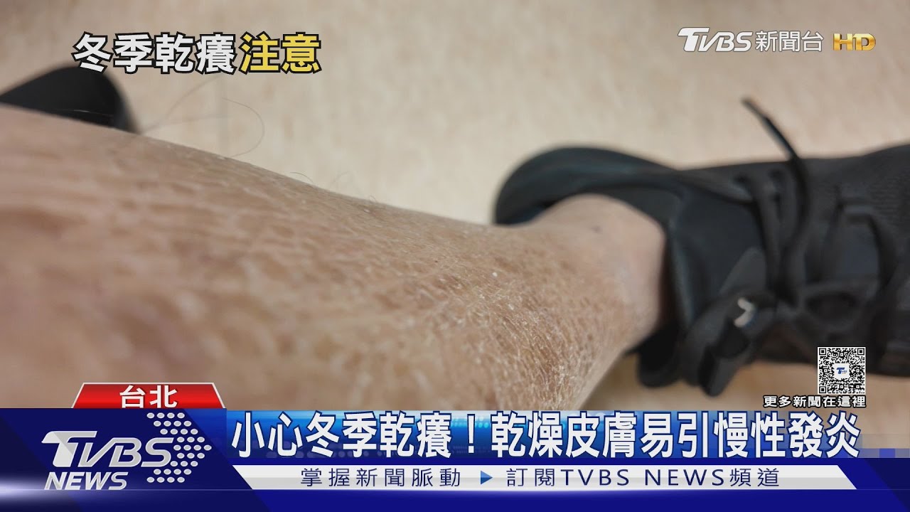 冬季乾癢好難受！ 醫揭「四肢最先發作」護膚秘笈大公開