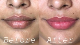 How to Lighten Dark Lips Naturally - Rapid Home Remedies