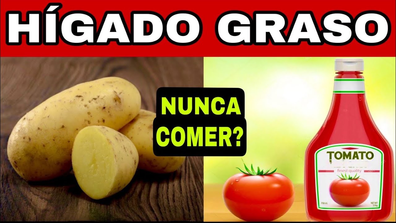7 Alimentos PROHIBIDOS para HÍGADO GRASO y 11 Mejores Alimentos y Hábitos para Grasa en el Hígado