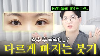 쌍수를 했는데 눈 모양이 이상해요...🤷‍♀️