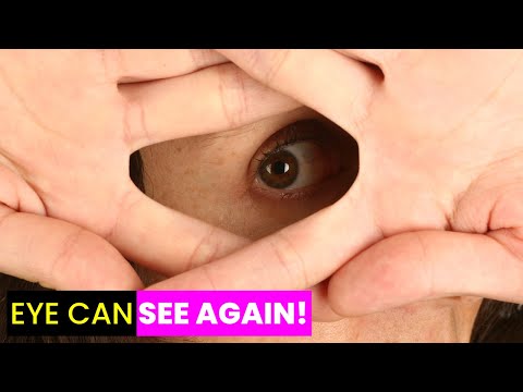 Retina Implants | Future Technology & Science News 514