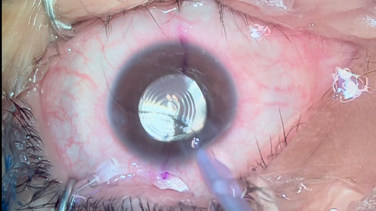 Jorge Alberto Martínez Mendoza-11