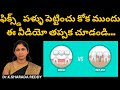 పోయిన పళ్లకు బెస్ట్ ఆప్షన్ Dental Implant Vs Teeth Bri