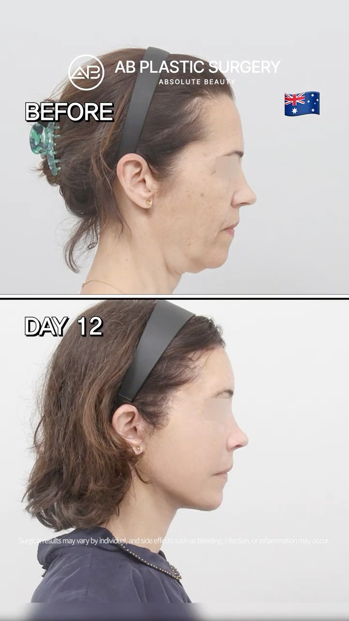Her Anti-Aging Transformation