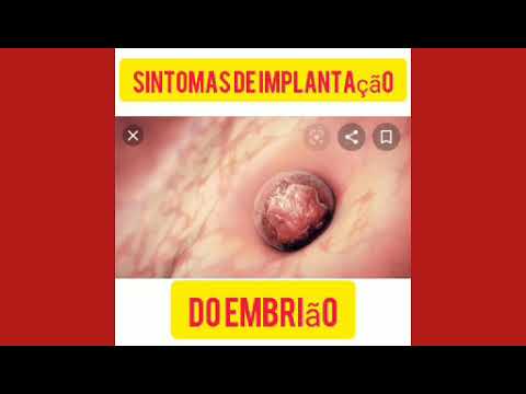 Sintomas.de implantação