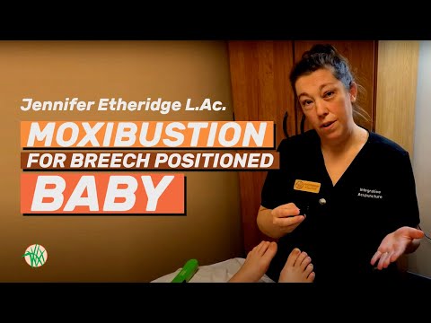 Moxibustion For Breech Positioned Baby with Jennifer Etheridge L.Ac.