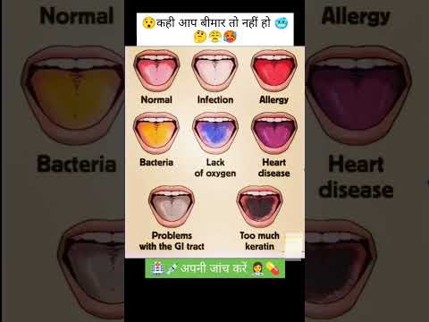 how to solve disease conditions | #2024 #english #facts #how #studyclasses58 #of #of #disease #is