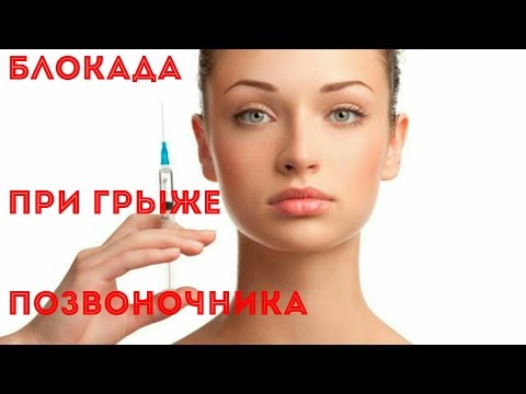 Стероидные препараты при артрозе коленного сустава Шейный отдел техника плавания