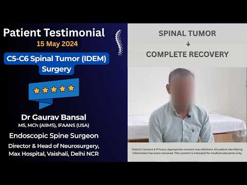 C5-C6 Spinal Cord Tumor | Patient Shares His Recovery Journey
