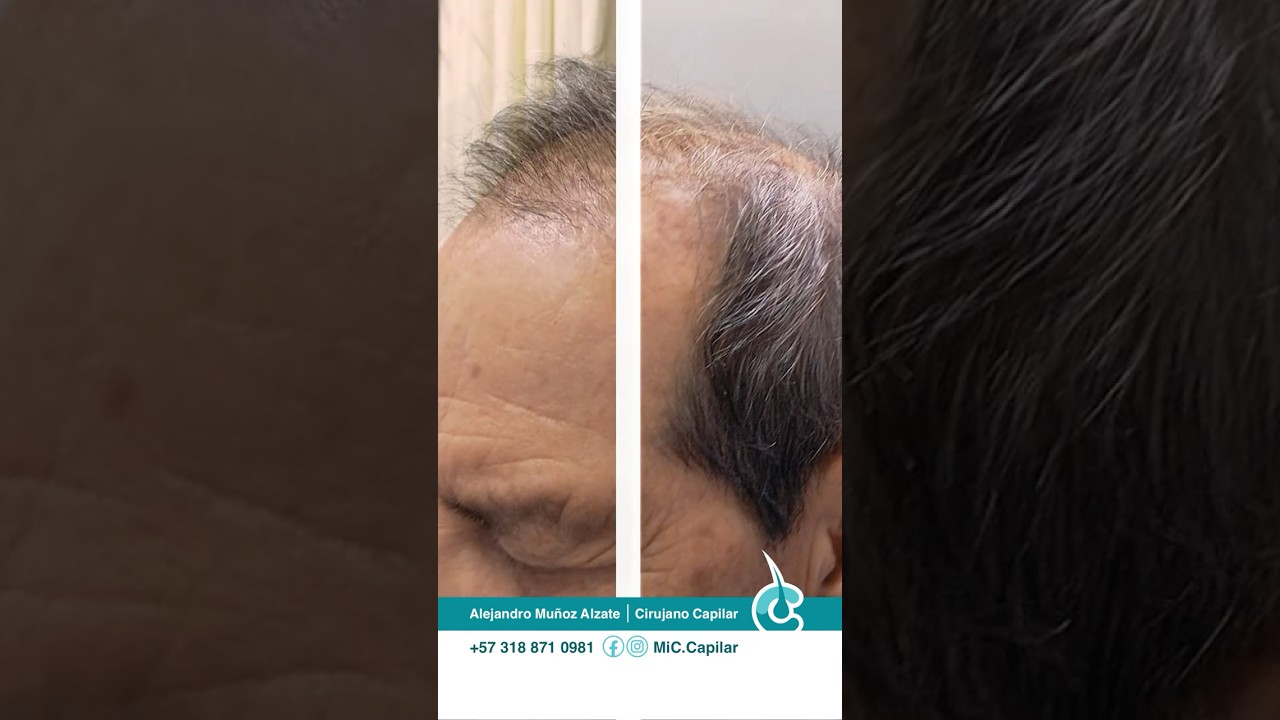 Alejandro Muñoz Alzate-9