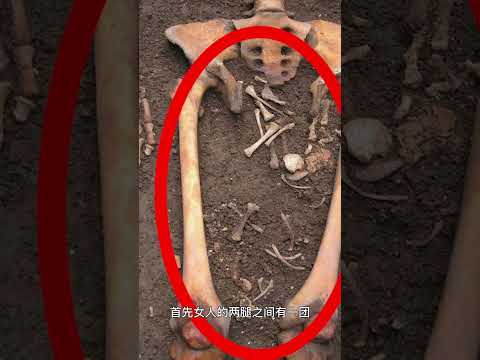 【死后分娩】孕妇去世还能自己生孩子？