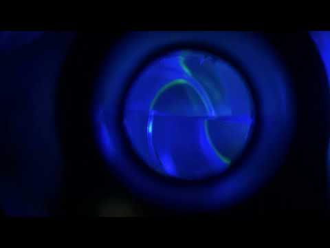 Goldmann Applanation Tonometry