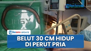 Dunia Medis China Heboh, Dokter Temukan Belut Sepanjang 30 Cm Berenang di Perut Seorang Pria