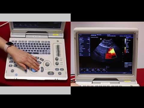 Mindray Z6: Basic overview of Doppler modes, M mode and ECG on the Z6 - video 5